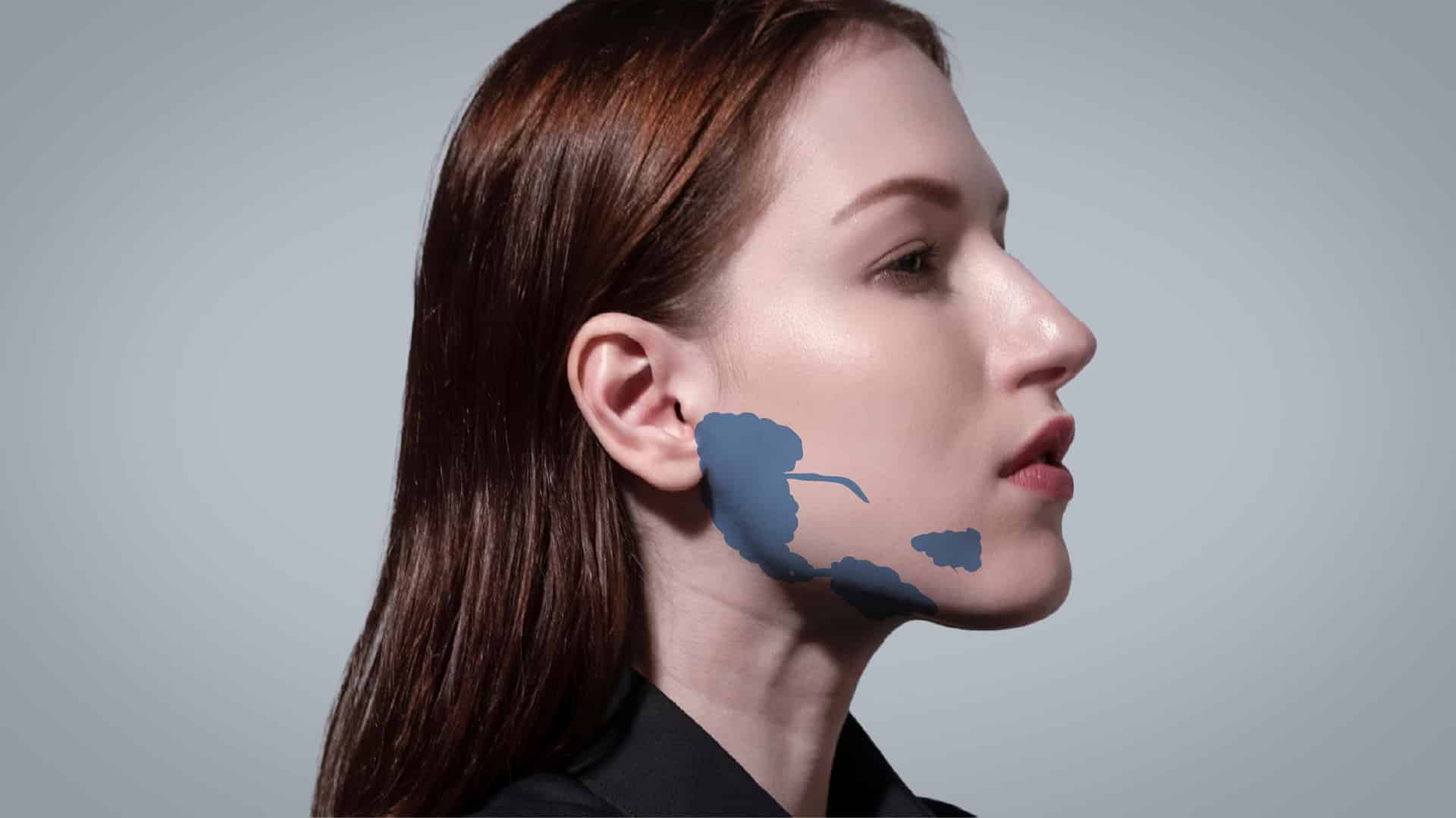 Salivary Glands