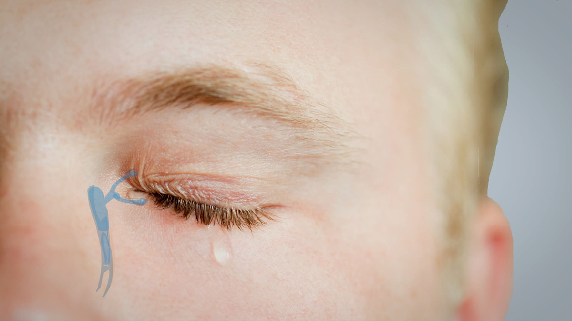 Lacrimal Pathway 1